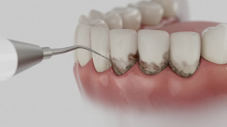 Reliable Dental contractor in Port Dickinson, NY by Dentist Open Now